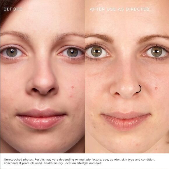 Rodan + Fields Lash BOOST Eyelash Serum Eyelash growth liquid Sealed 5ml-2PACK - Picture 5 of 8